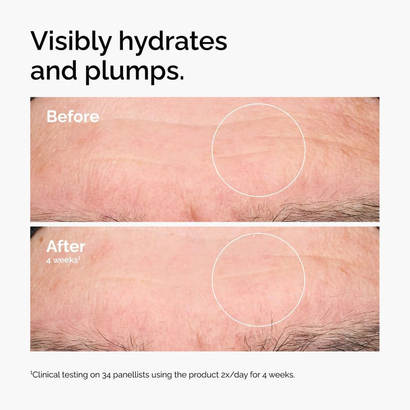 Hyaluronic Acid Serum with Ceramides