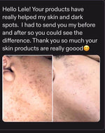 Complete Radiance Skincare Bundle