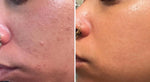 Complete Radiance Skincare Bundle